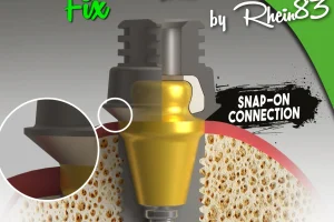 Ezie Fix